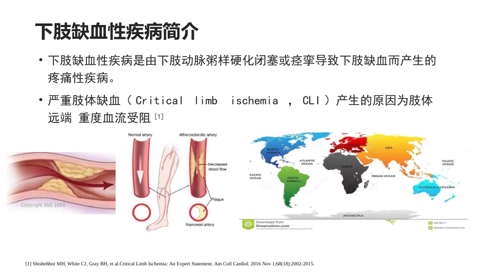 SCS治疗下肢缺血性疾病_第3页