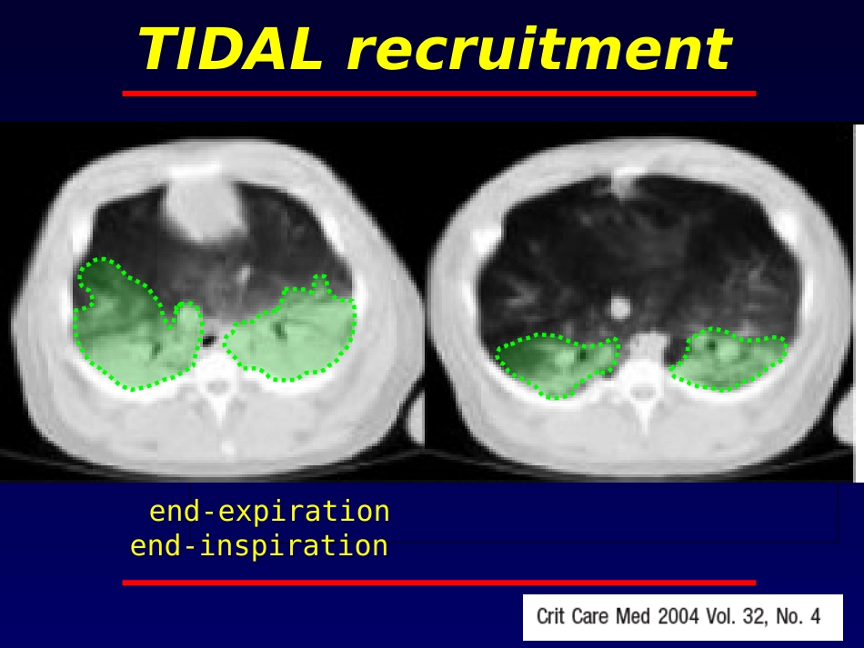 stressindex病理生理基础_第3页
