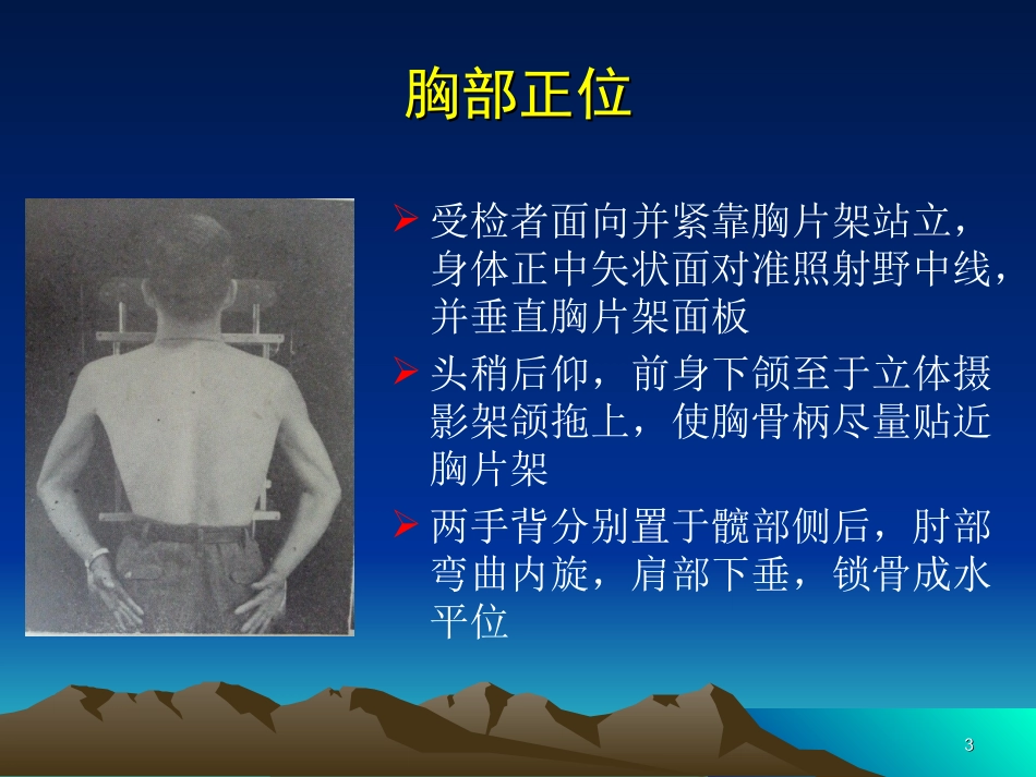x线常规体位的标准及规范_第3页