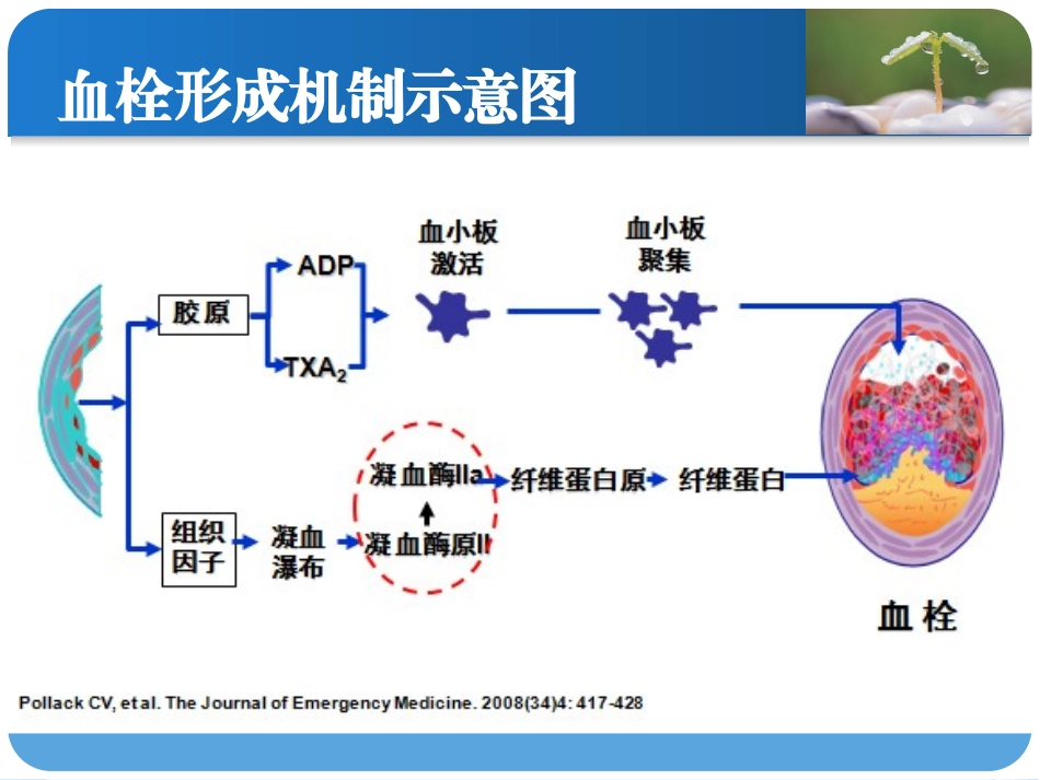 阿加曲班和脑梗死_第2页