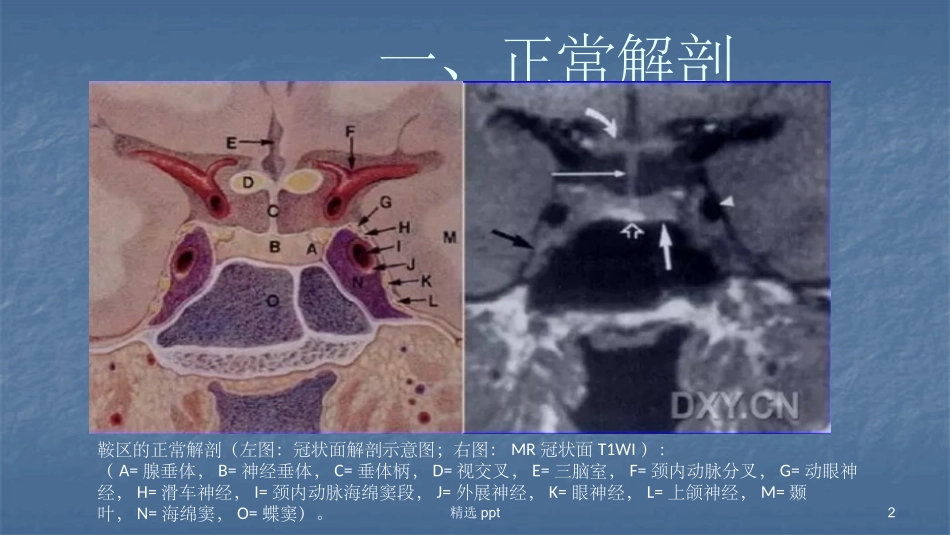 鞍区病变影像诊疗_第2页