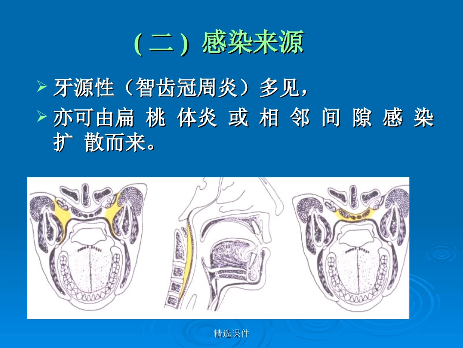 八咽旁间隙parapharyngealspace感染_第2页