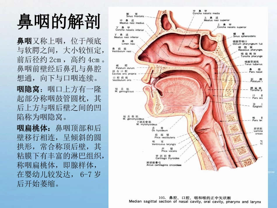 鼻咽部纤维血管瘤_第2页