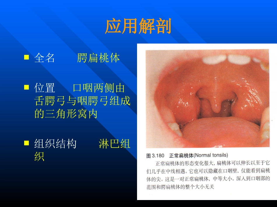 扁桃体讲课课件_第3页