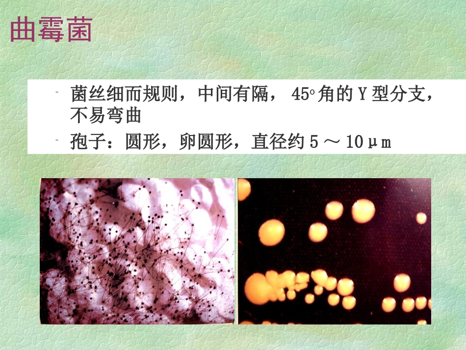 变应性支气管肺曲霉病课件_第2页