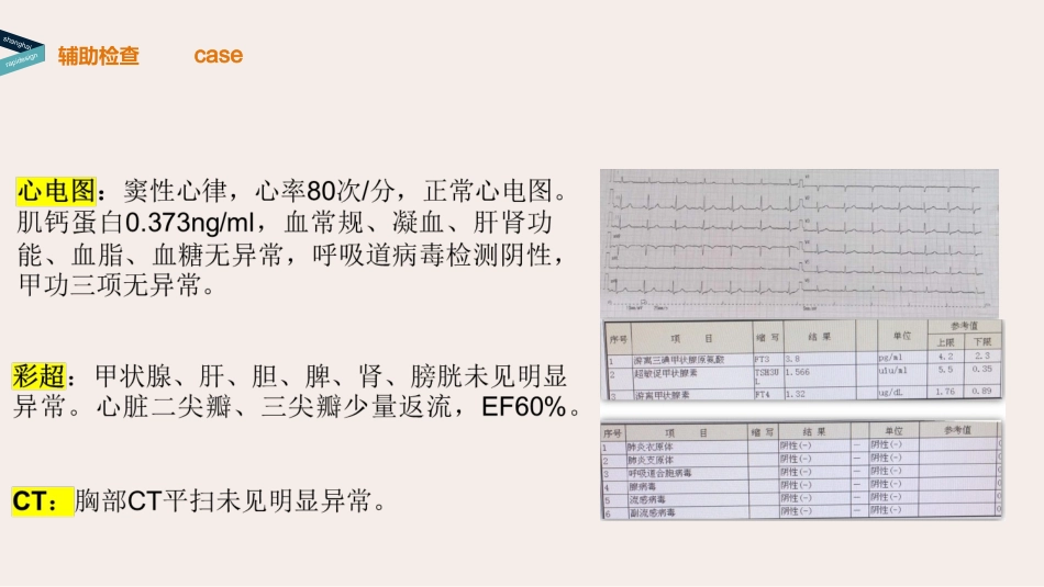 病毒性心肌炎的发病机制PBL教学_第3页
