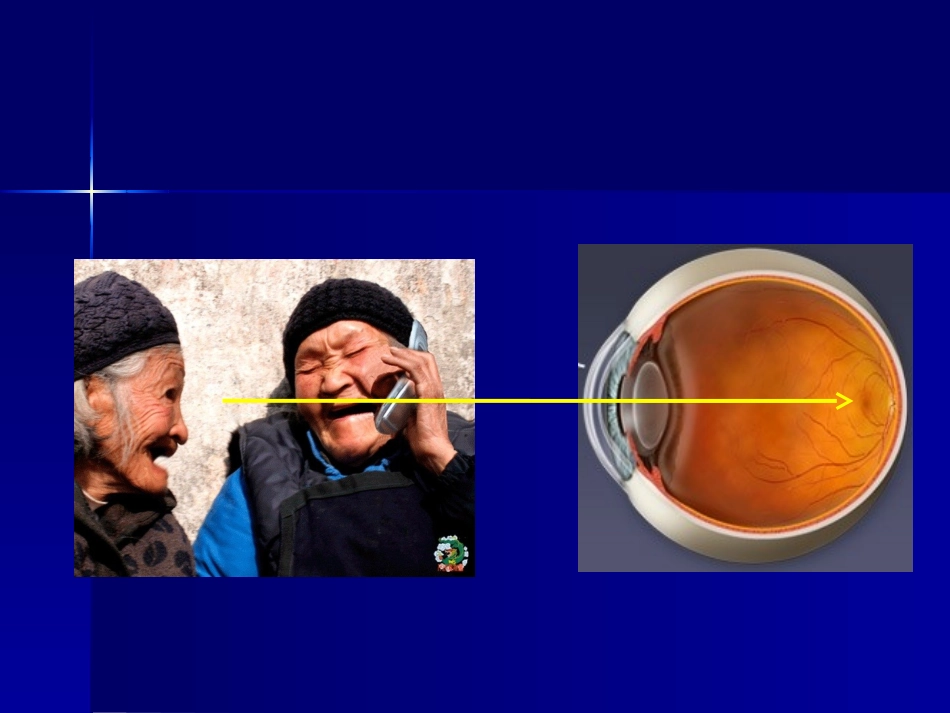 玻璃体视网膜疾病_第2页