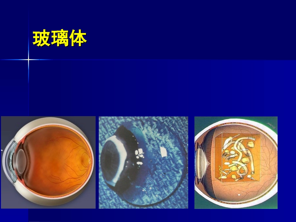 玻璃体视网膜疾病_第3页