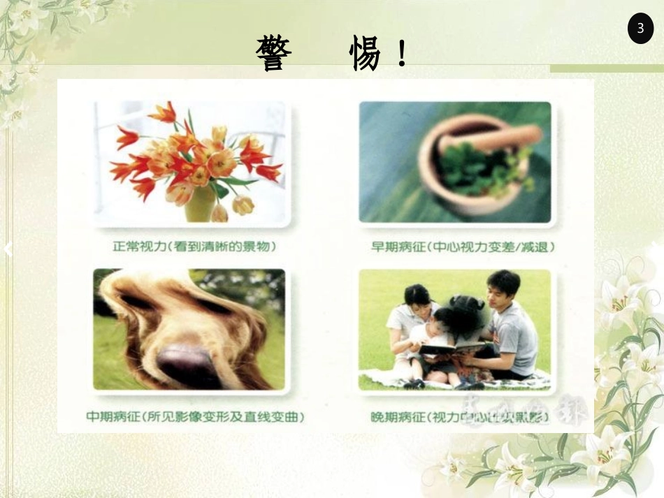 玻璃体手术并发症的预防及处置_第3页