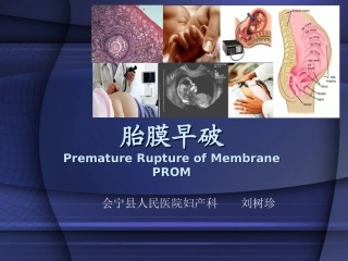 产科胎膜早破产科学课件讲义