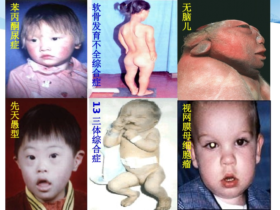 产前诊疗相关知识课件_第2页