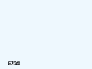 肠癌护理查房