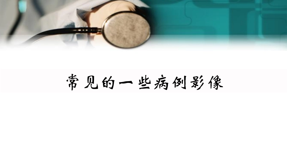 常见的口腔病例影像医学课件_第1页