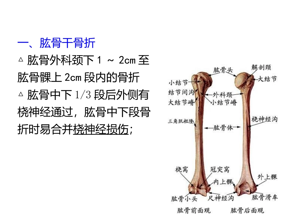 常见的四肢骨折护理要点_第2页