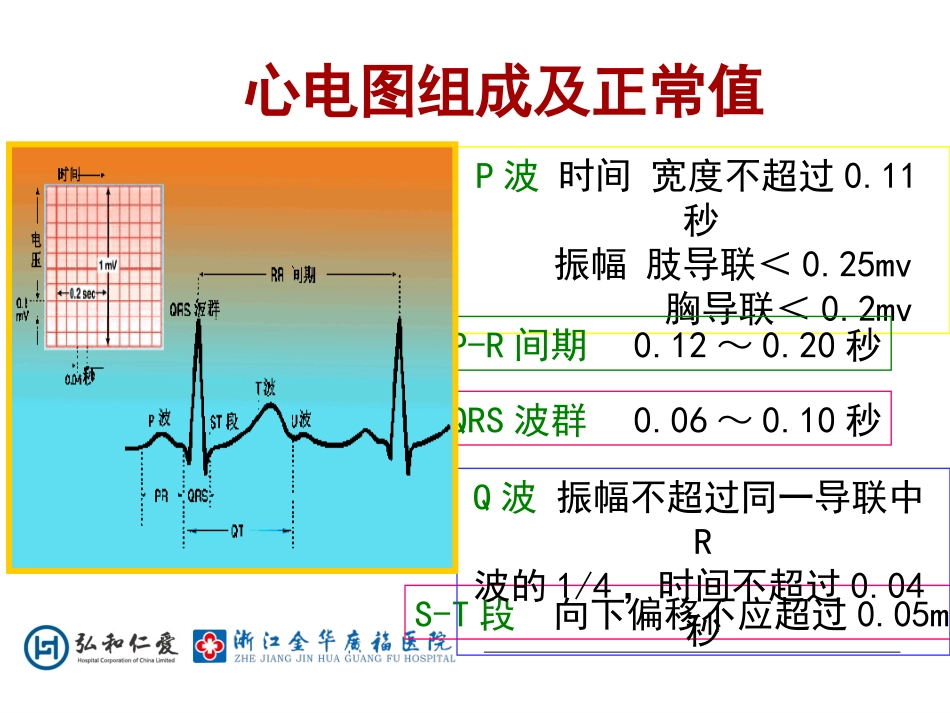常见恶性心律失常的处置_第3页
