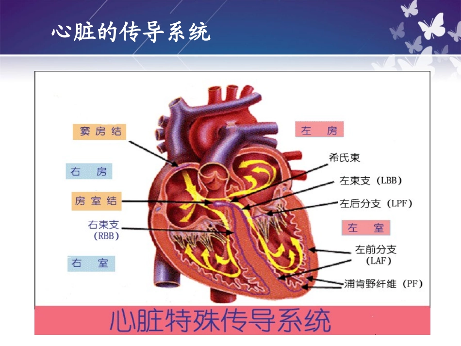 常见心律失常的观察和护理_第3页