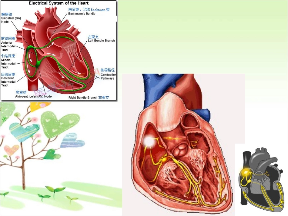 常见心律失常的心电图识别_第3页