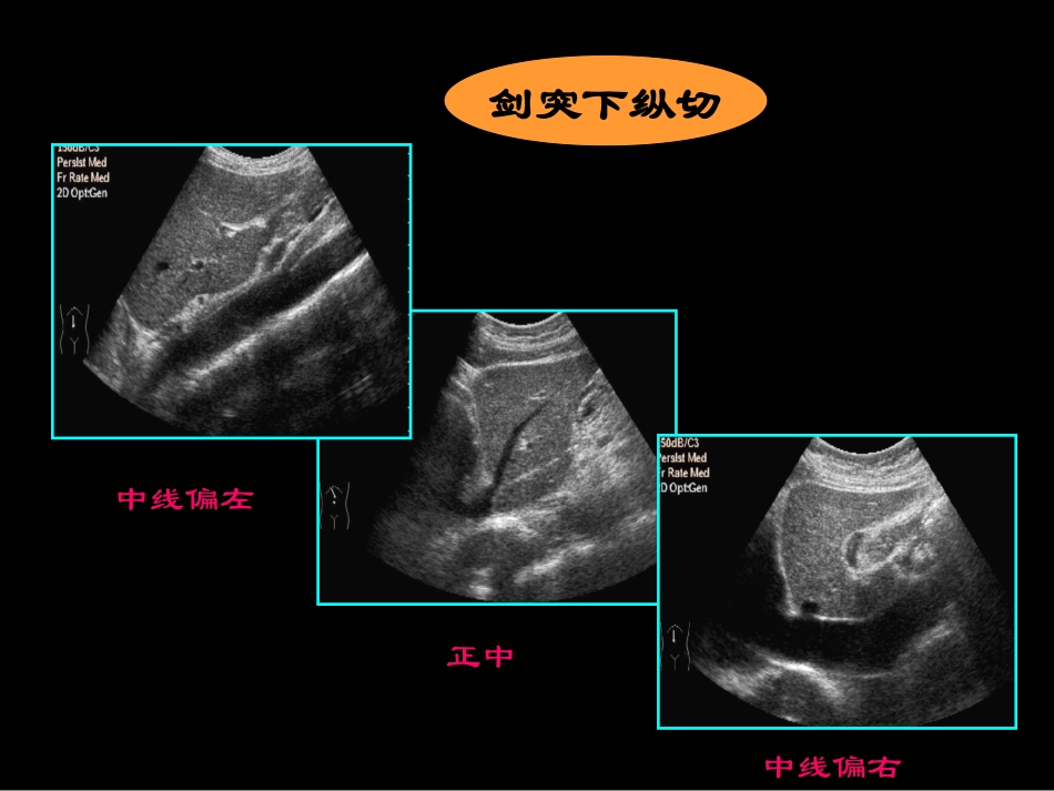 超声肝胆胰脾_第3页