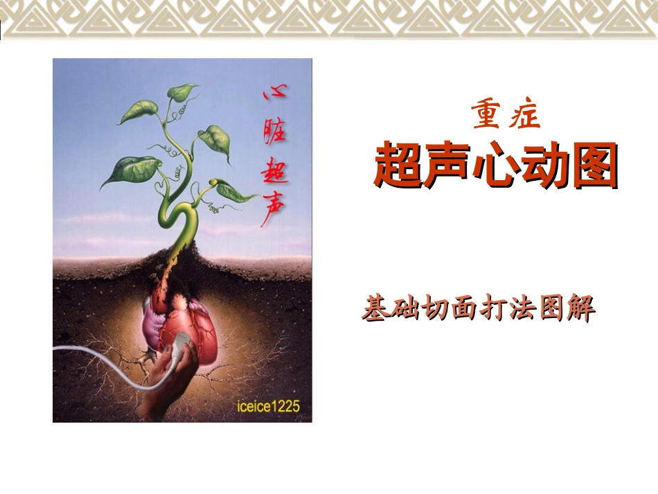 超声心动图常用切面图解_第1页