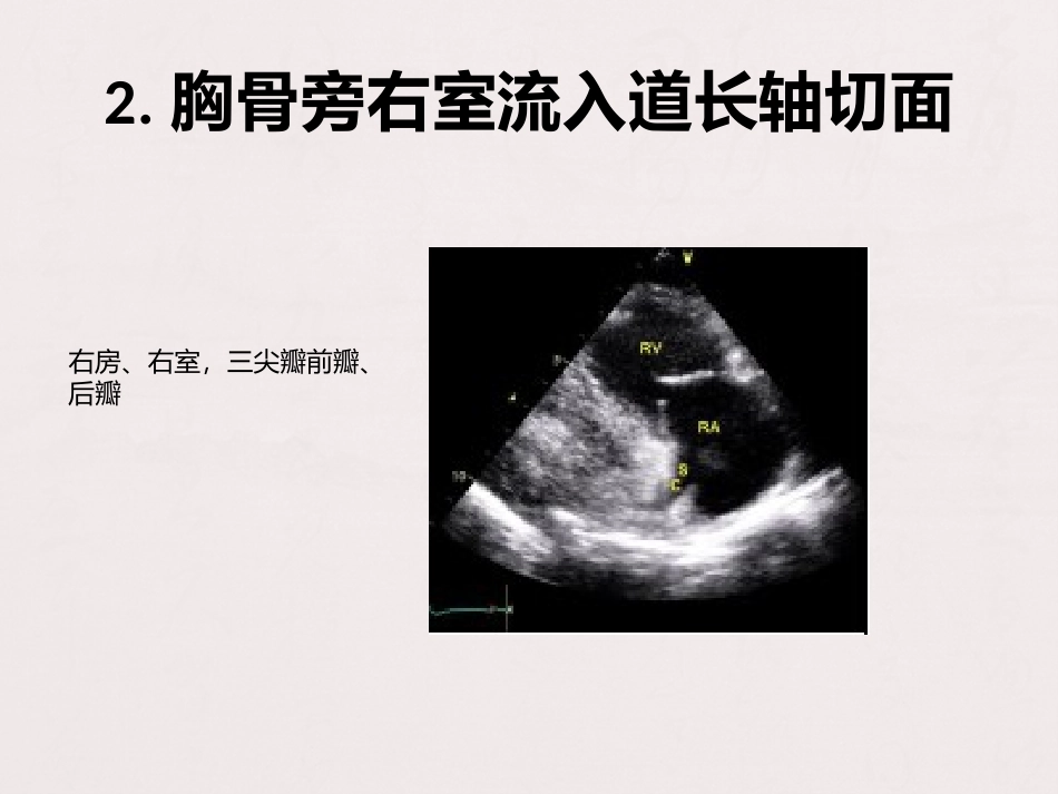 超声心动图规范_第3页