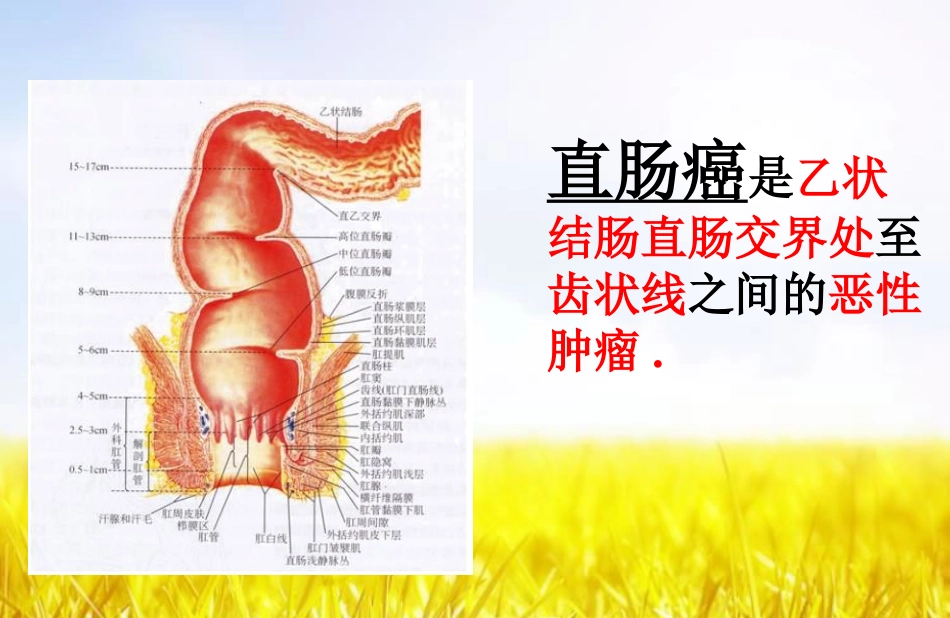 大肠癌筛查居民健康教育_第3页