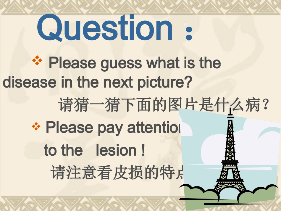 带状疱疹精选_第2页