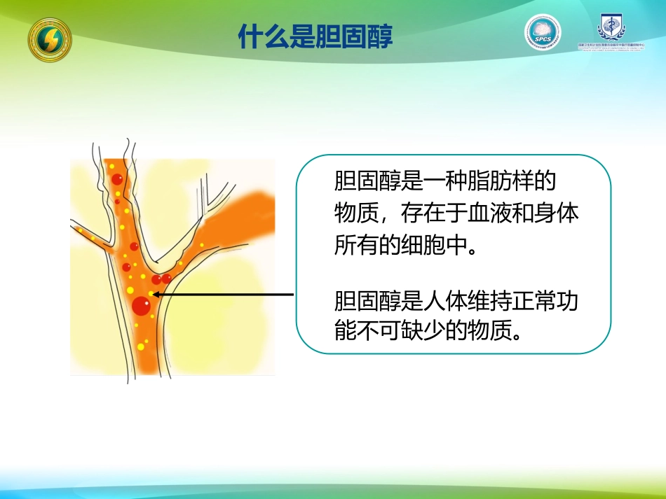 胆固醇和动脉粥样硬化立普妥_第3页