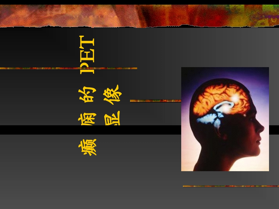 癫痫的PET显像_第1页