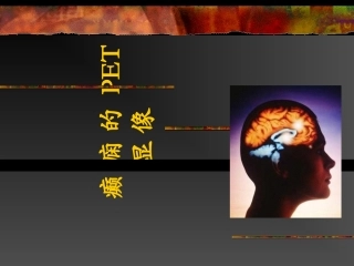 癫痫的PET显像