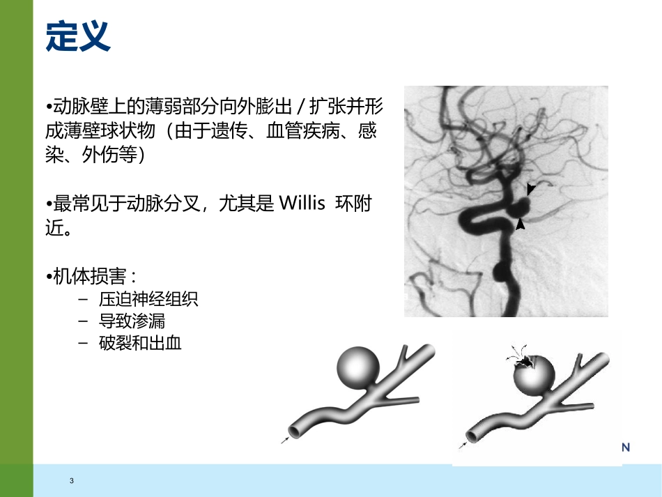 动脉瘤疾病知识及诊疗治疗_第3页