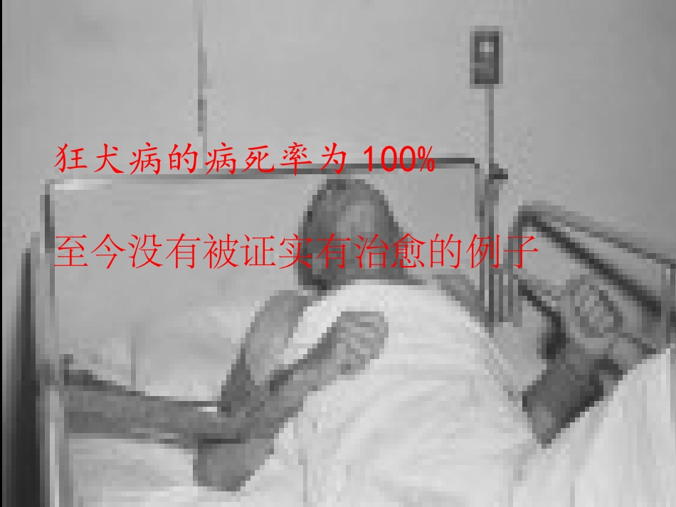 动物咬伤处置流程及疫苗注射注意事项_第3页