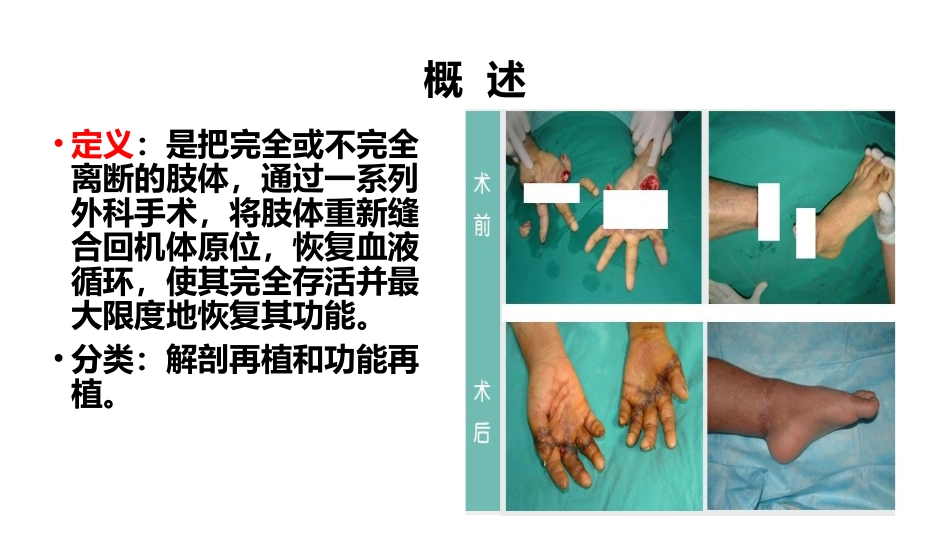 断肢指再植病人的护理_第2页