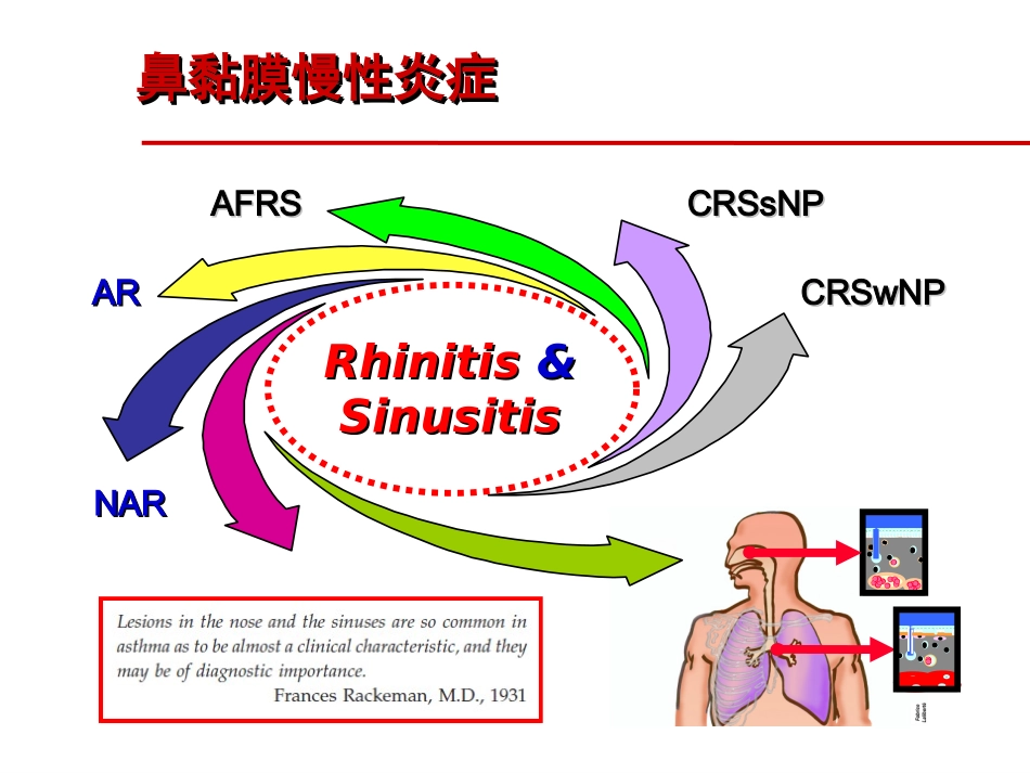 耳鼻咽喉头颈科学鼻科学慢性鼻窦炎鼻息肉_第2页