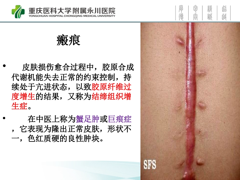 耳部瘢痕疙瘩讲诉_第3页