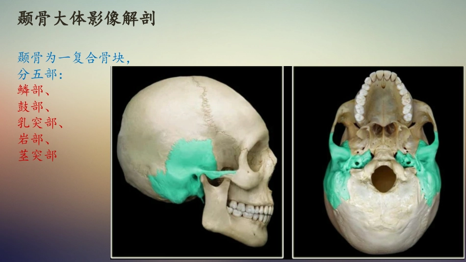 耳部基本影像解剖周政_第2页