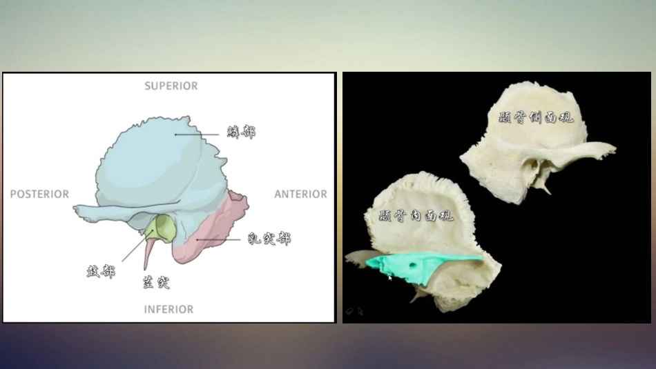 耳部基本影像解剖周政_第3页