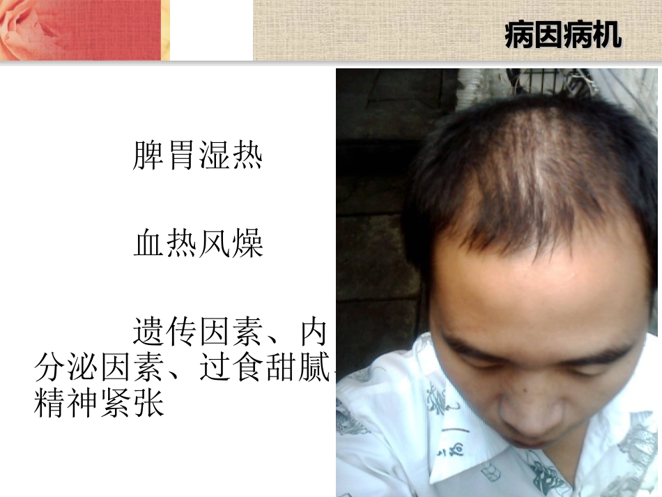 发蛀脱发油风白发_第3页