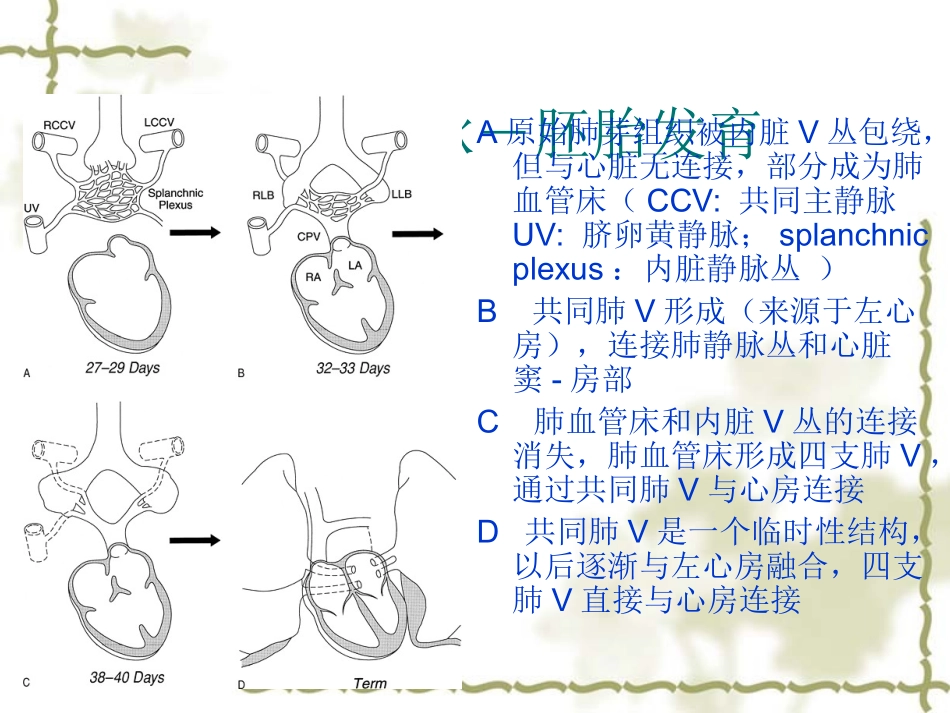肺静脉异位引流修改_第3页