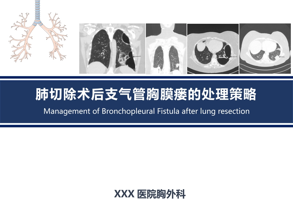肺切除术后支气管胸膜瘘的处置策略_第1页