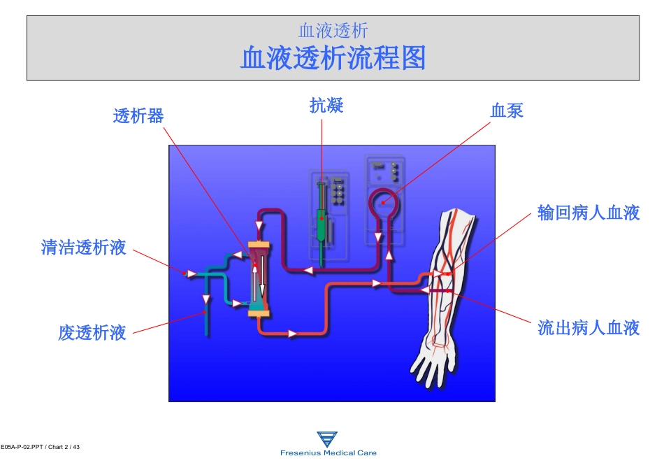 费森尤斯透析器知识_第2页