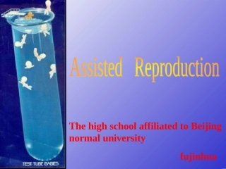 辅助生殖技术主要包括人工授精体外受精胚胎移植
