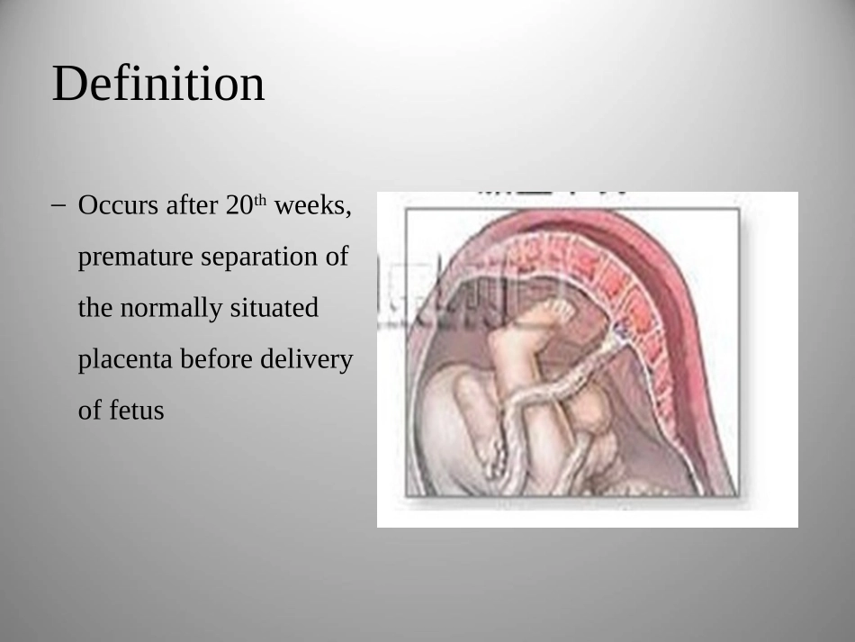妇产科学课件胎盘早剥英文版_第2页