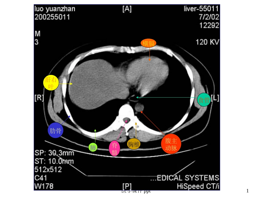 腹部CT断层解剖结构_第1页