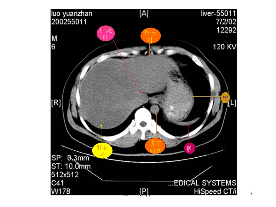 腹部CT断层解剖结构_第3页