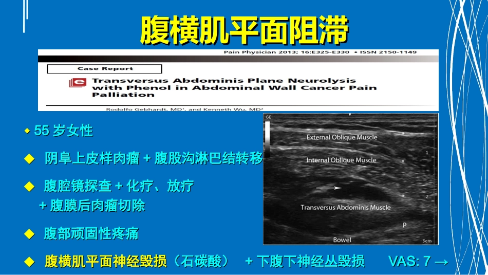 腹部神经阻滞应用解剖沙龙讲义_第3页