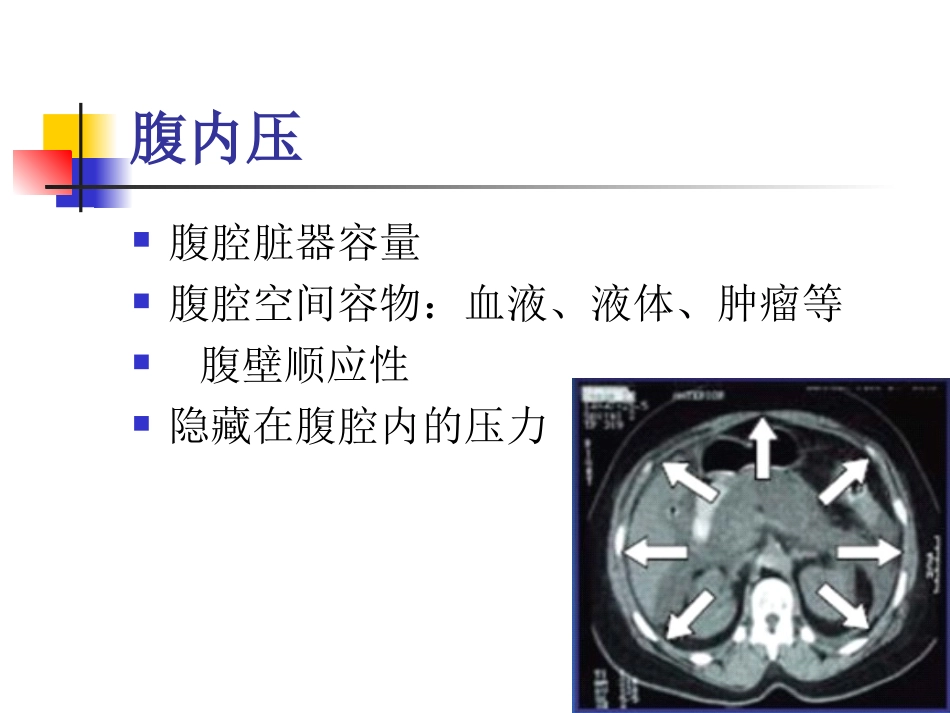 腹腔间室综合征腹内高压_第3页
