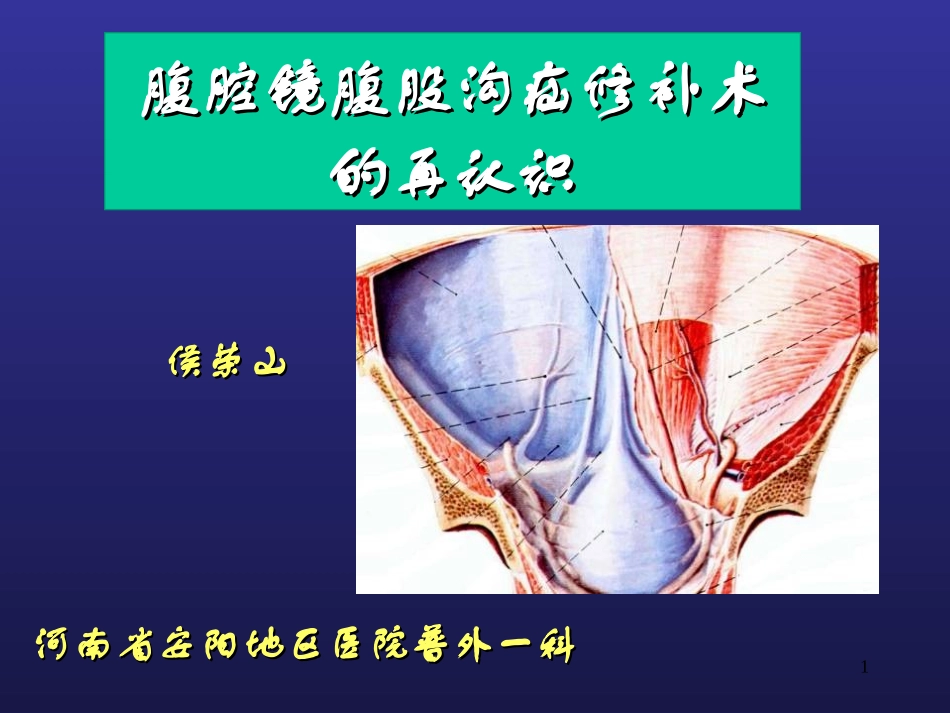 腹腔镜腹股沟疝修补术的再认识_第1页
