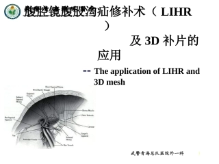 腹腔镜腹股沟疝修补术讲诉