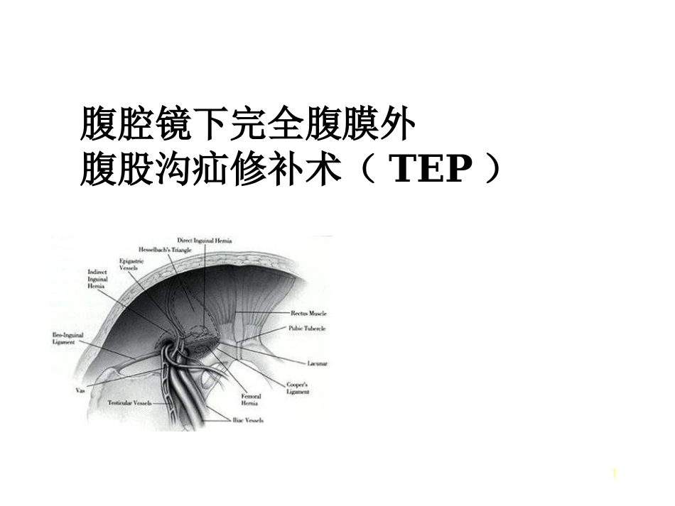 腹腔镜下完全腹膜外腹股沟疝修补术TEP_第1页