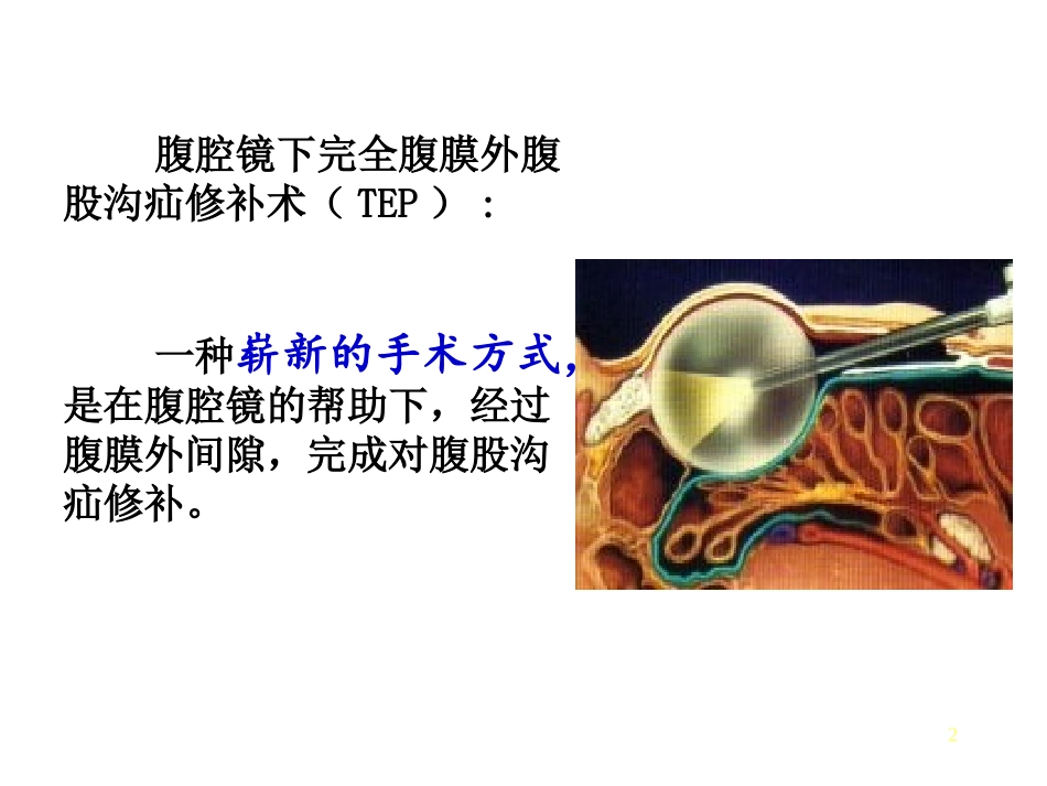 腹腔镜下完全腹膜外腹股沟疝修补术TEP_第2页